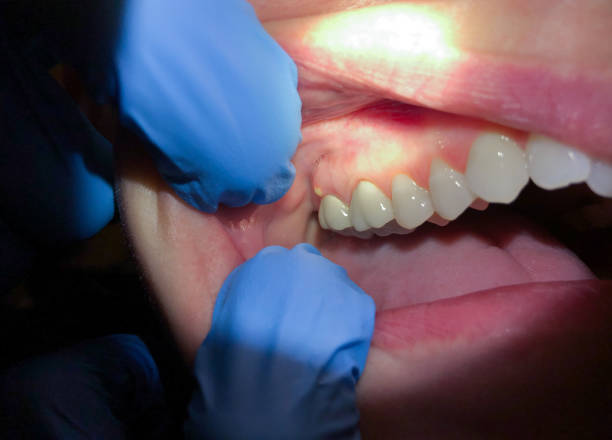 Best Same-Day Emergency Dentist in Red Hill, PA